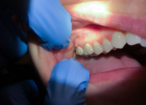 Best Same-Day Emergency Dentist in Boiling Springs, SC